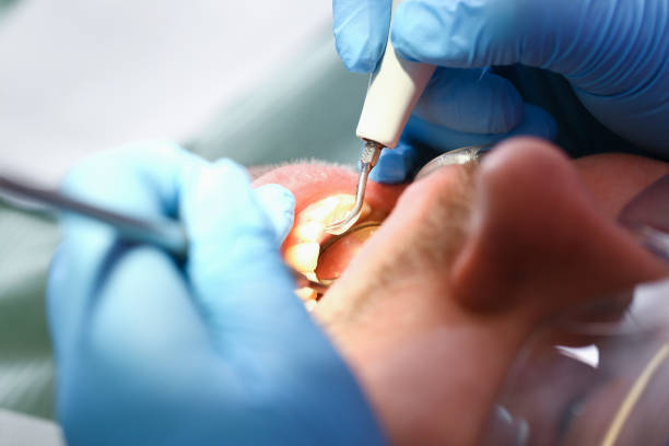 Best Urgent Care for Lost Fillings or Crowns in Deer Park, TX