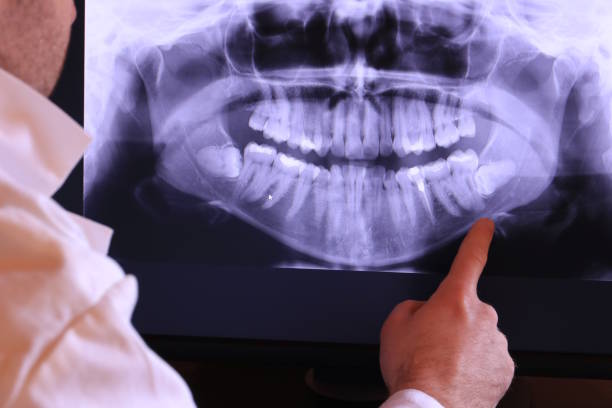 Best Emergency Treatment for Dental Infections or Abscesses in Deer Park, TX