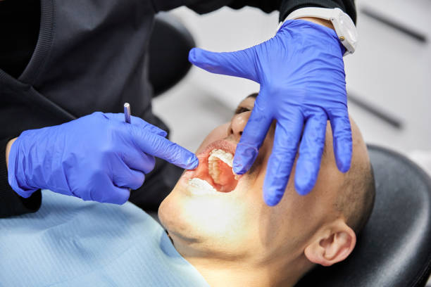 Best Emergency Wisdom Teeth Removal in Deer Park, TX